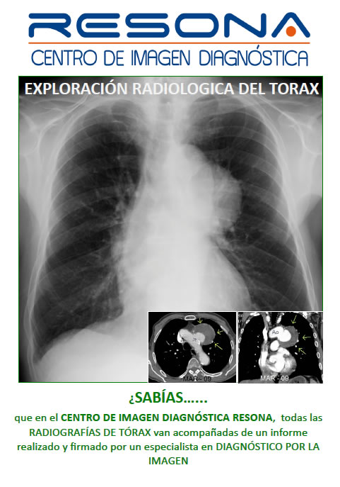 Exploración Radiologica del Torax