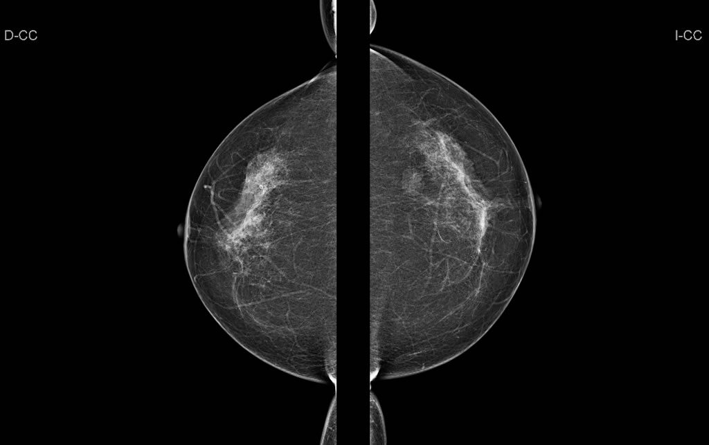 Sesión formativa de mamografía para los TSED de Resona