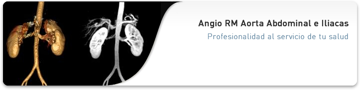 Angio RM Aorta Abdominal e Iliacas