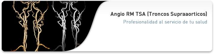Angio RM TSA (Troncos Supraaorticos)
