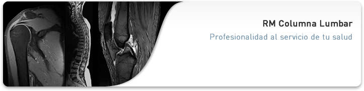 RM Columna Lumbar