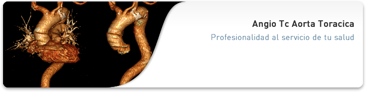 Angio Tc Aorta Toracica